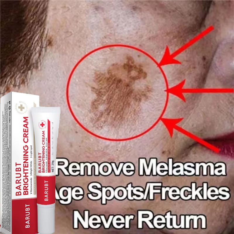 Skincare Vitamin C - 強力なシミ除去美白クリーム 肌を素早く明るくする メラニン色素沈着、肝斑、黒ずみを解消 韓国スキンケア